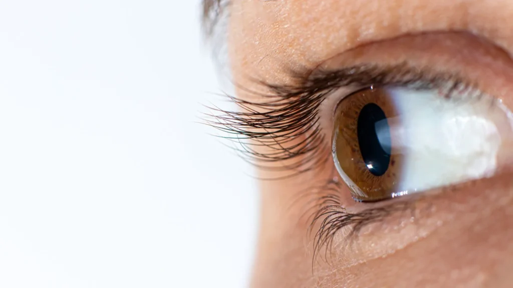 What is Corneal Crosslinking?