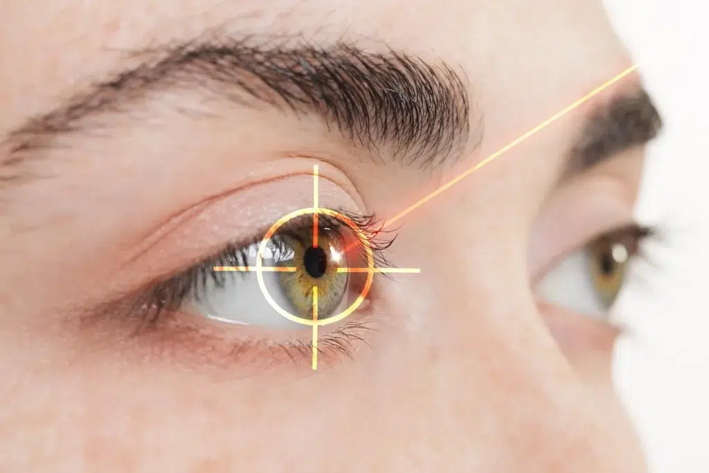 How Old Do You Have to Be to Get LASIK Eye Surgery?