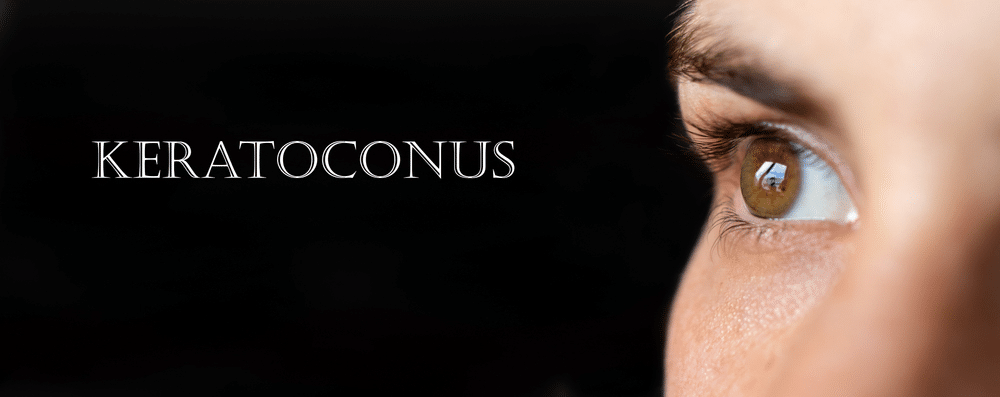 Corneal Crosslinking in Holly Springs, NC and Fayetteville, NC